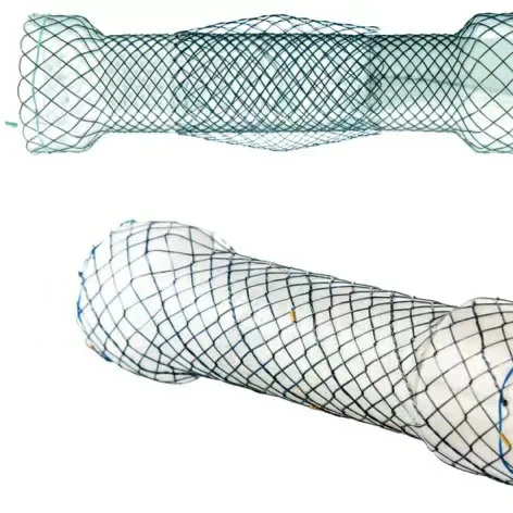 Anti-Reflux Esophageal Stents High radial force Resistant and elastic covering High radiopacity
