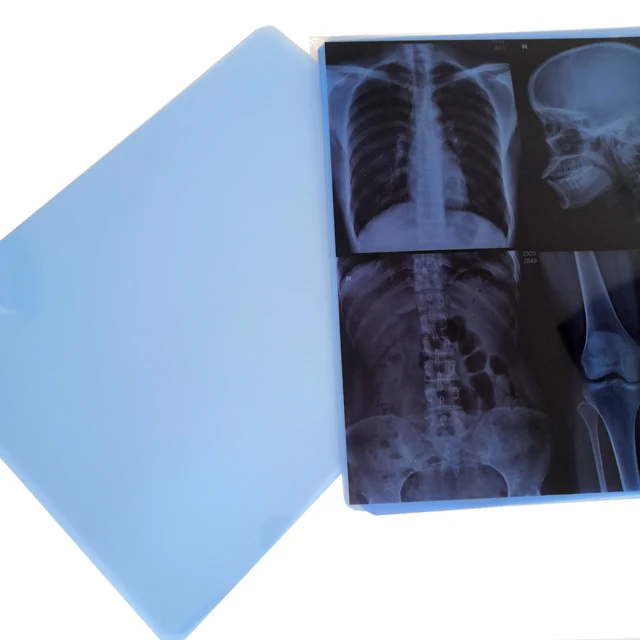 30*40 35x43cm medical x-ray film marker fixer manual processing of x-ray tube and tank