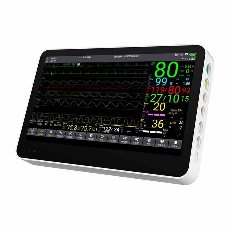 CONTEC CMS8500 портативный медицинский монитор пациента 14 дюймов мониторинг