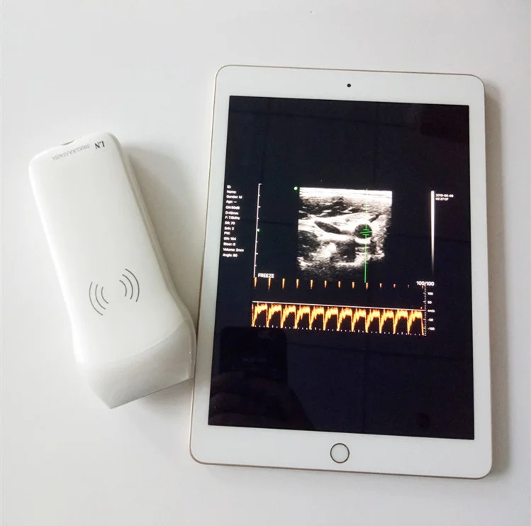 linear portable ultrasound diagnosis equipment with needle biopsy guide