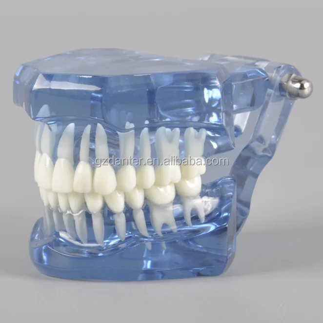 Новая модная Стоматологическая прозрачная модель, ортодонтика без кронштейнов