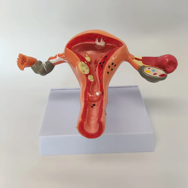Female Plastic  Uterus Ovary Anatomical Model Vagina Model Normal/diseased Uterus Model