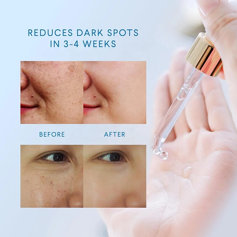 Best Sales 30ml Private Label Organic Face Skin Care Serum Moisturizing 377 Whitening Pale Spots Essence