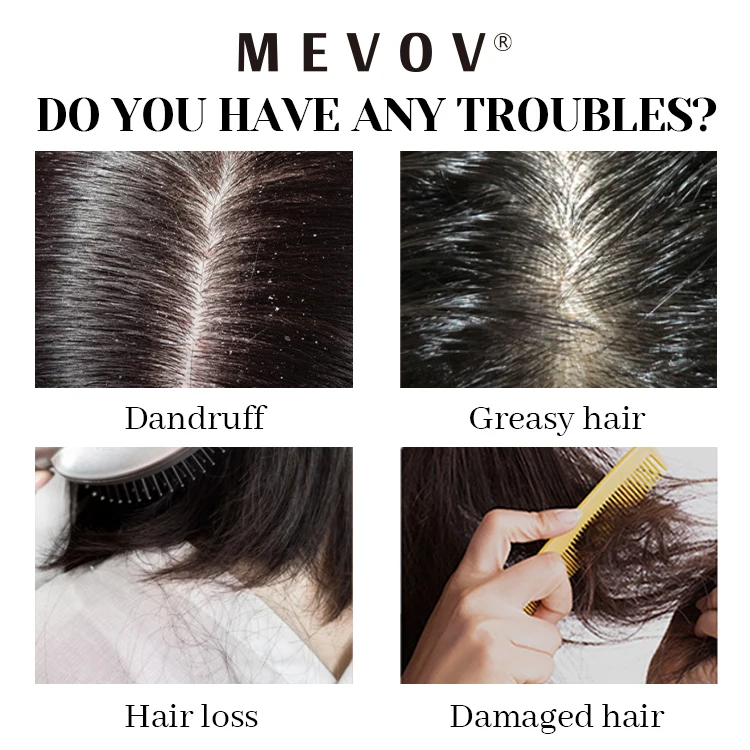 Private Label Hair Growth Moisturizing Maintenance Smooth Amla Shampoo