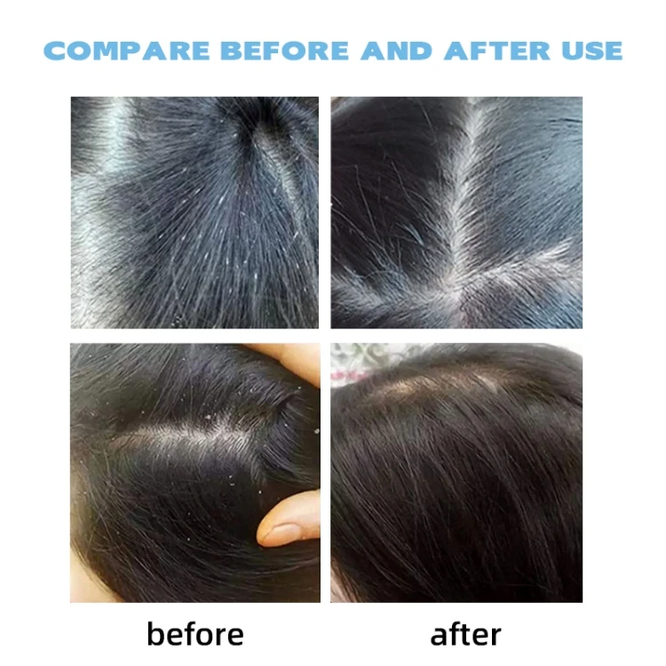 Private Label Organic Baby Hair Gel Shampoo Natural Moisturizing Anti-Lice Nits Safety Prevention for Children