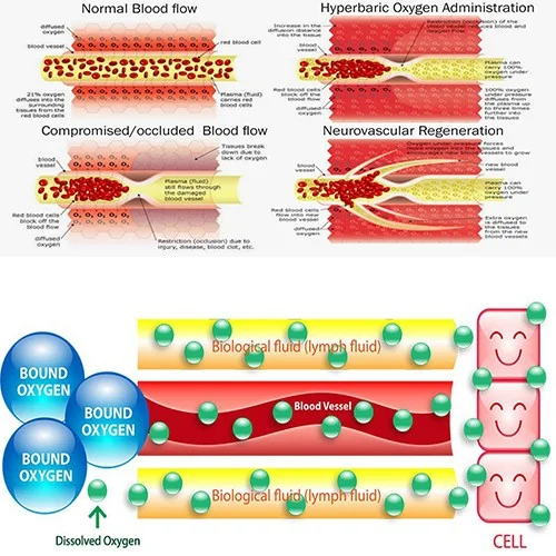HBOT Macy-pan Sitting Type  macy-pan portable hyperbaric oxygen tent ST2200 for keep fit