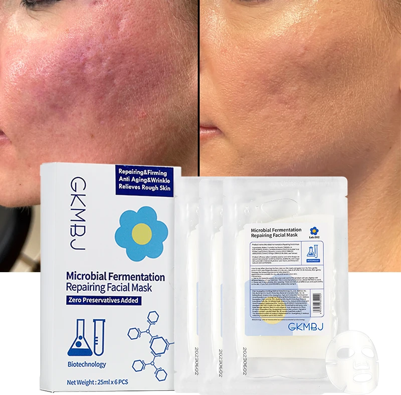 microbial fermentation face mask hydrolyzed collagen,sensitive rough skin anti aging wrinkle whitening repairing facial mask