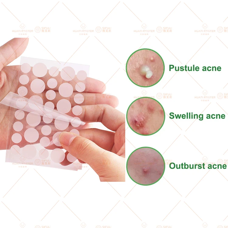 Huati Sifuli RubioAroma pimple healing patch pimple acne organic all natural pimple patches 36 dots