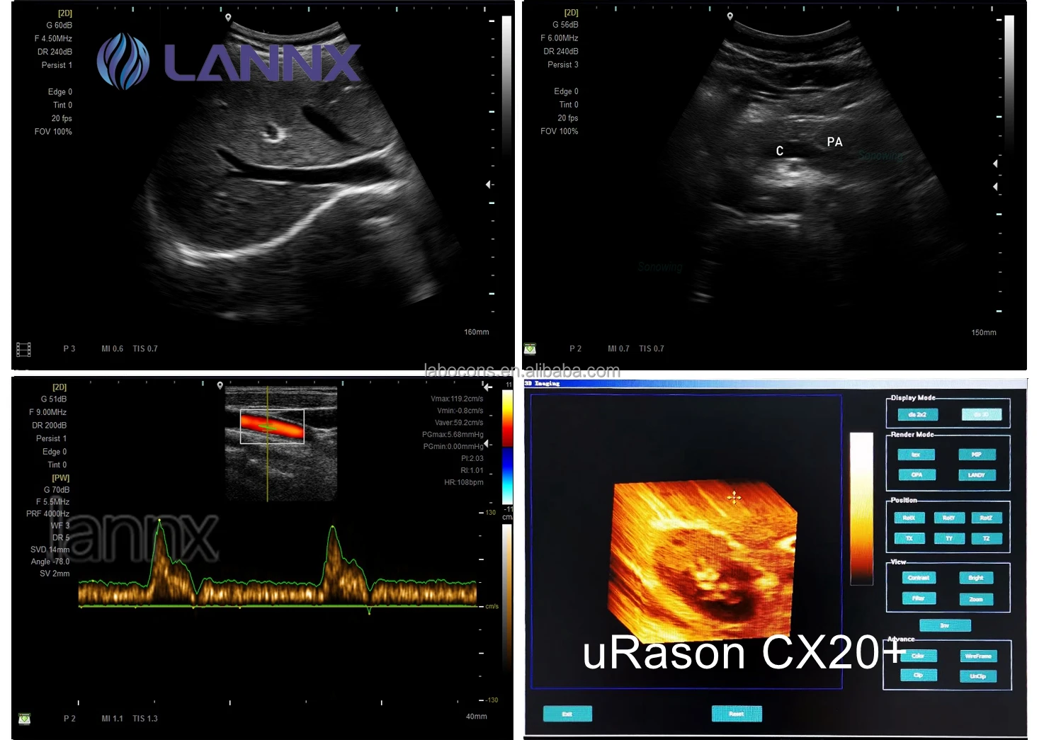 LANNX uRason CX20+ Multipurpose Color Doppler Ultrasound Portable Digital Ultrasonido Laptop 2D 3D ultrasonic Scanner