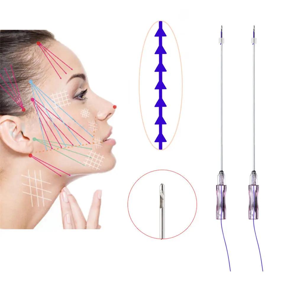 Non-Surgery Absorbable 19G 100mm Blunt W Needle Face Lifting Fishbone Molding Cog Pdo Thread