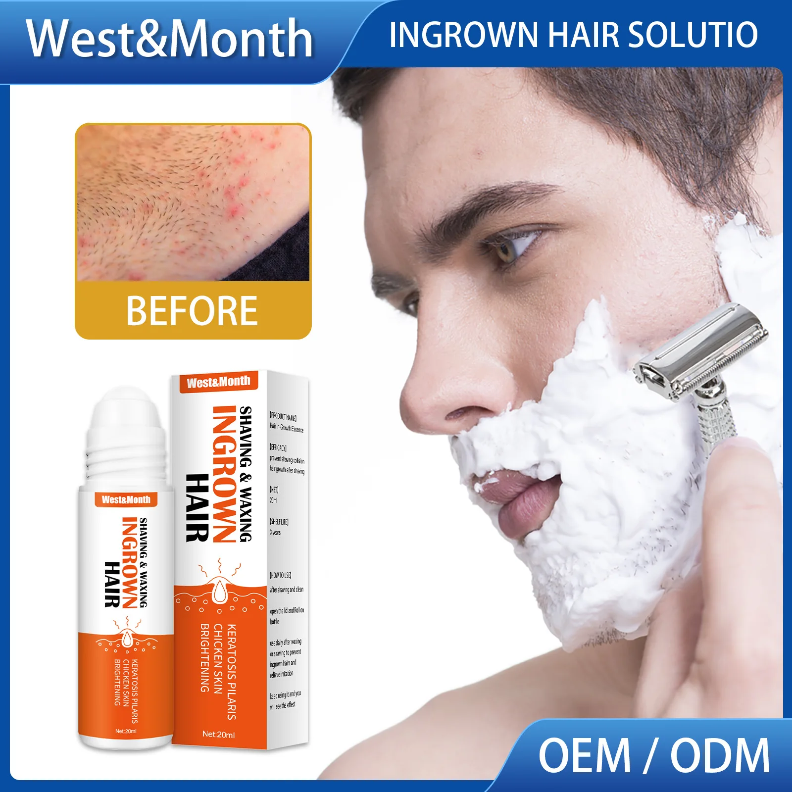 West&Month Hair Inner Hair Essence reduces redness and swelling prevents ingrown hair soothes after shave