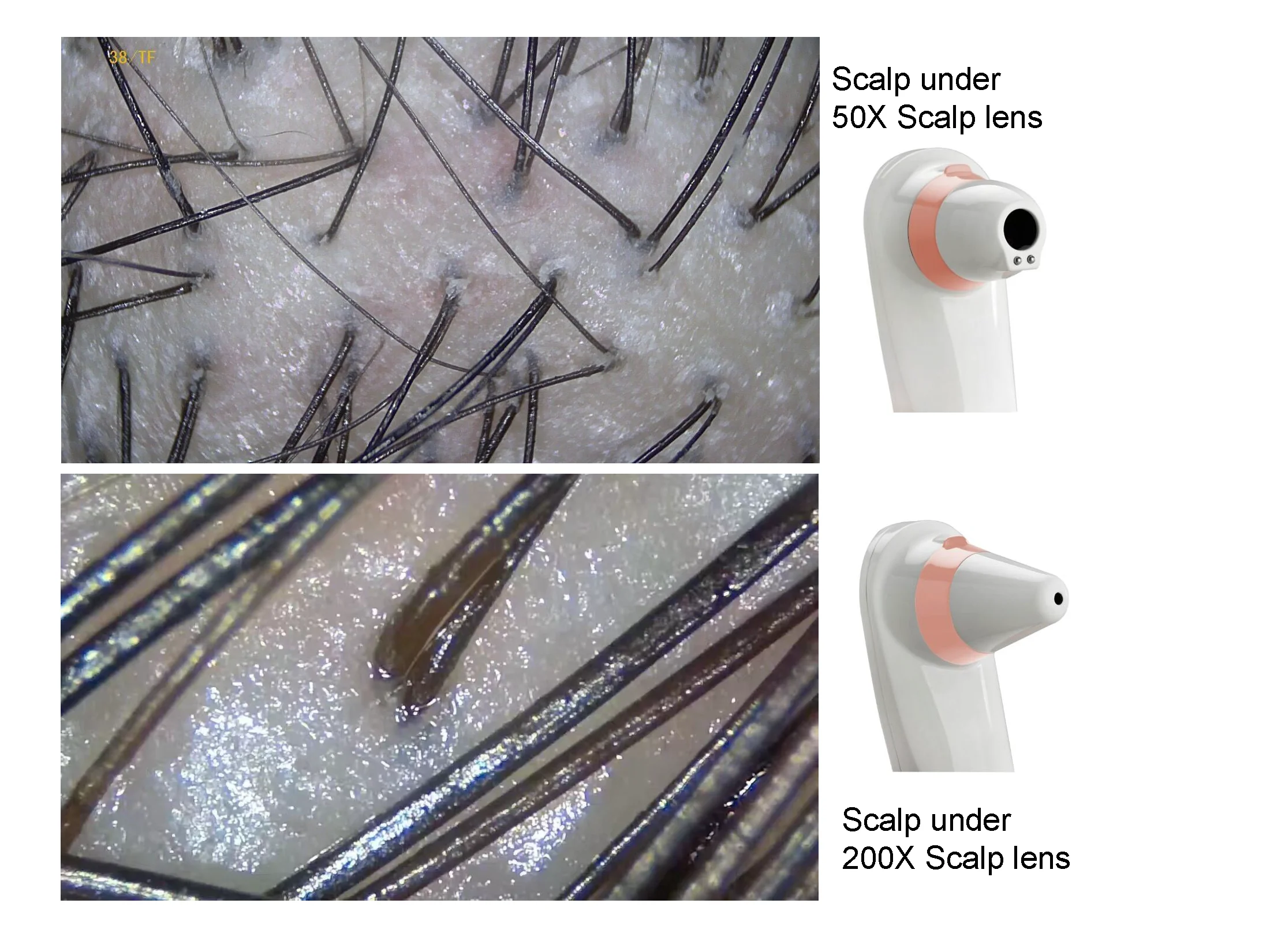 the most sold professional facial machine wireless wifi UV skin analyzer portable 5g Hair scalp analyzer scanner