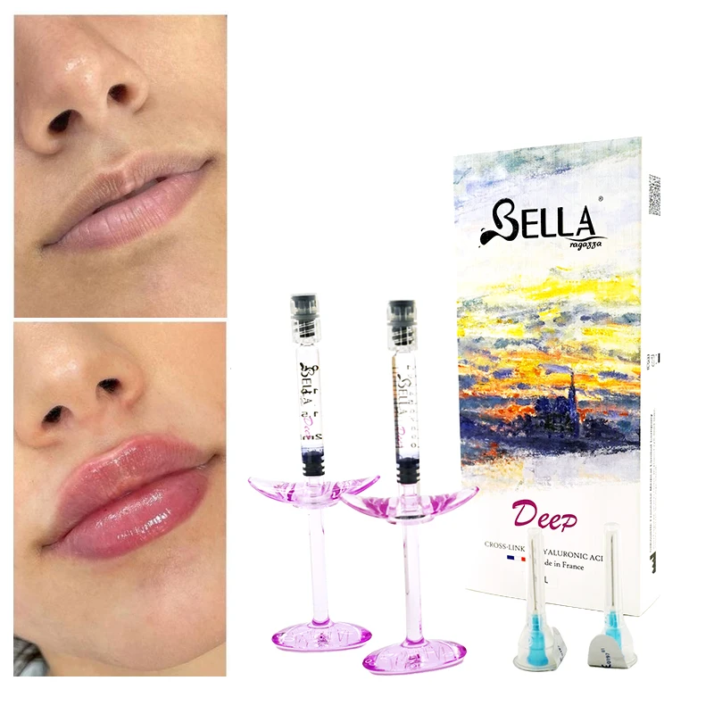Bella Dermal Filler Hyaluronic Acid Gel Injectable With Lido Fillers For The Face Injection OEM/ODM