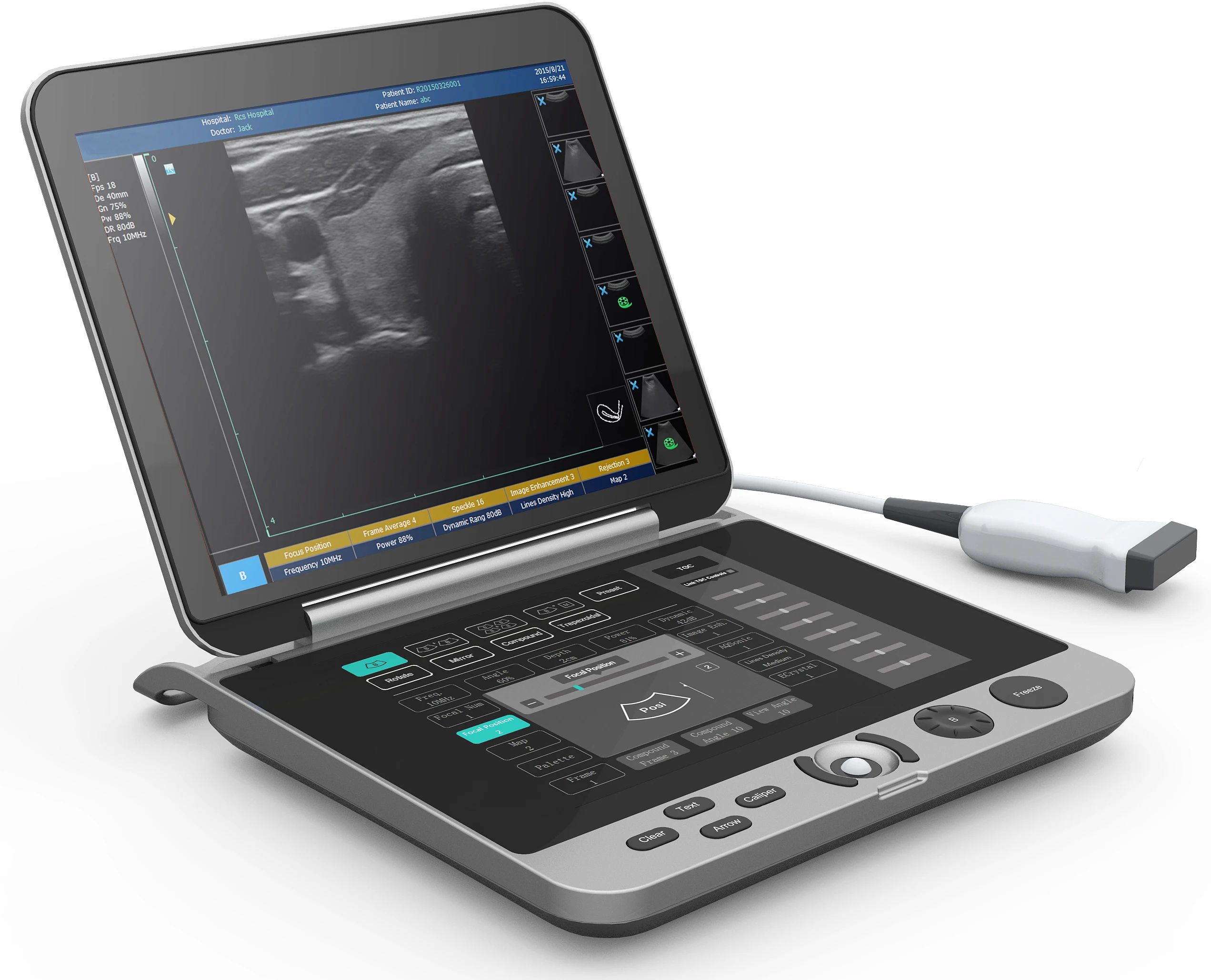 High resolution  laptop B/W ultrasound MSK  ultrasound scanner  laptop ultrasound machine