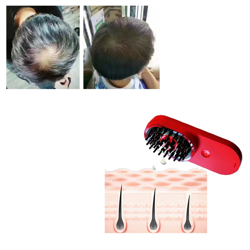 Electric Infrared LED Light Therapy Negative -ION Nutrition Lead-in Hair Regrowth Growth Massage Comb