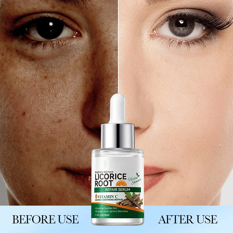 Vitamin C Licorice Root Kojic Acid Skincare Glutathione Serum Skin Whitening Facial Serum for Dark Spots Remover