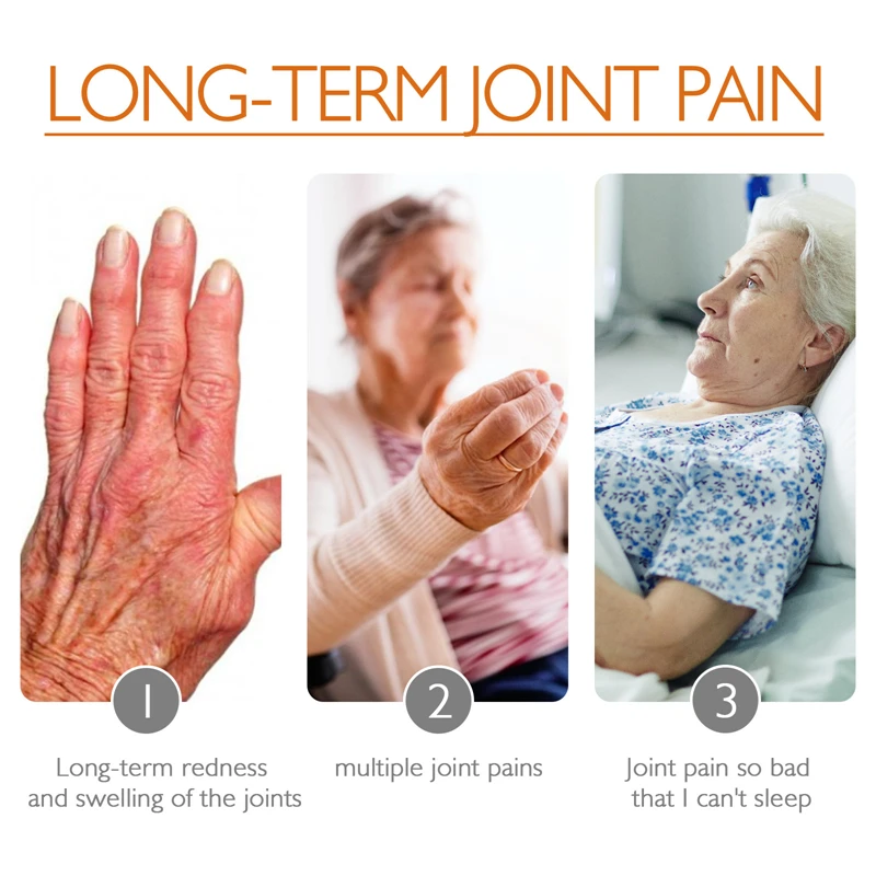 Ximonth 59g honey bee joint bone cream kee shoulder lumbar discomfort relieving pain soothing cream