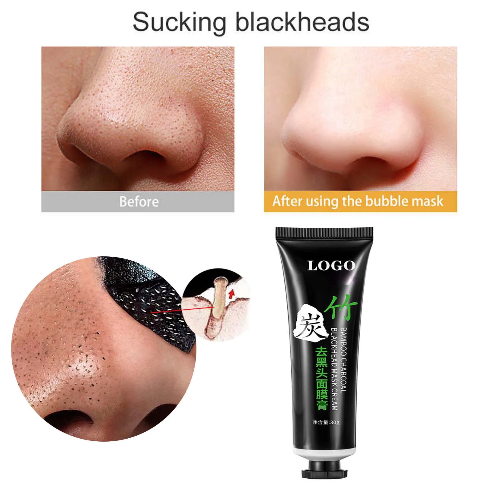 skin lifting remove blackhead dermabrasion peeling japanese all natural facial green tea updated blackhead removal