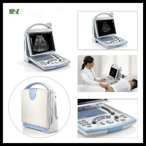 Ergonomic Digital Mindray DP20 Price / Summer Sale!! Portable 12.1 Inch LED Black & White Ultrasound