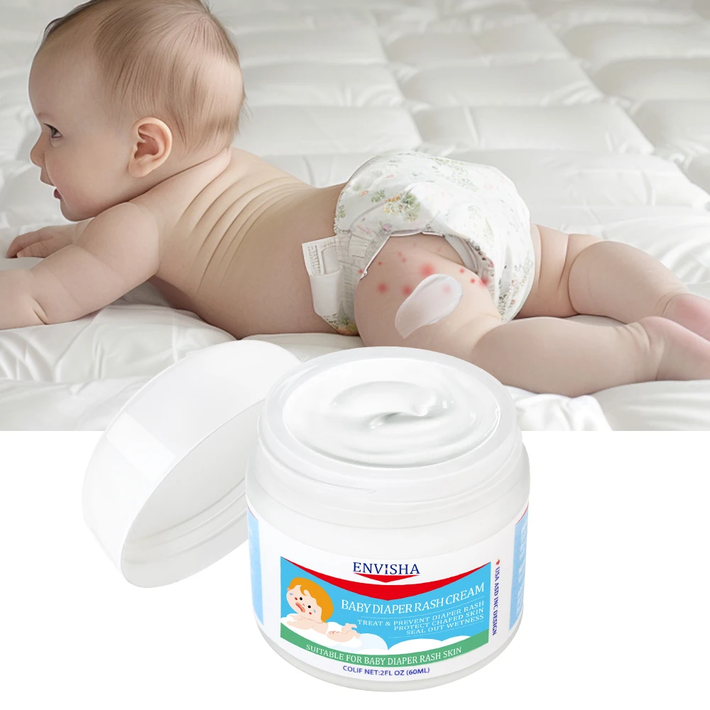Natural Moisturizing Calming Babies Diaper Rash Ointment Children Anti Chafing Bed Sores Skin Protectant Treatment Cream