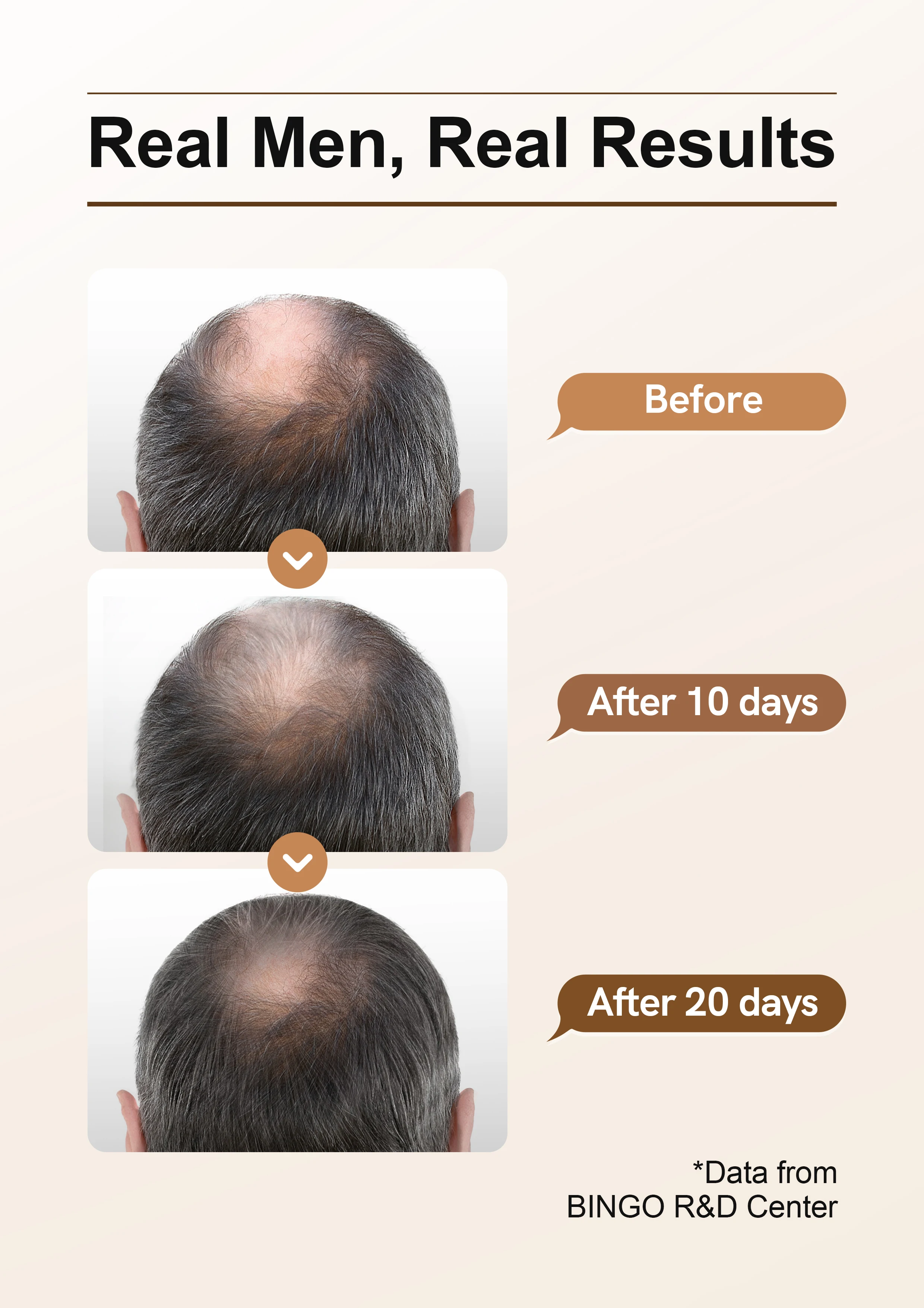 Bingo Organic Ginsenoside Soothing Scalp Anti Hair Loss Hair Care Treatments Ginger Extract Growth Serum Shampoo Hair Care Set