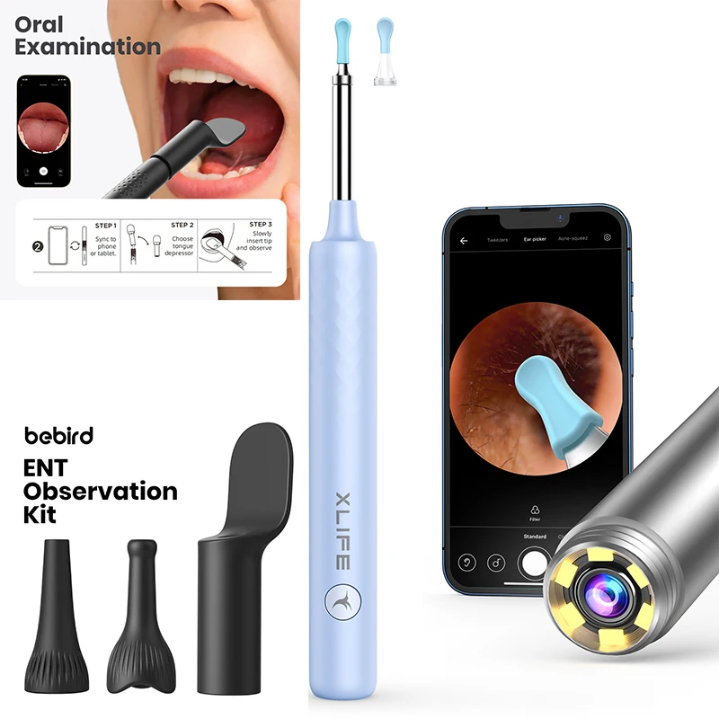 New Health Care Ear Nose Throat Examination Video Otoscopio Wifi Otoscope Wireless Endoscope Camera