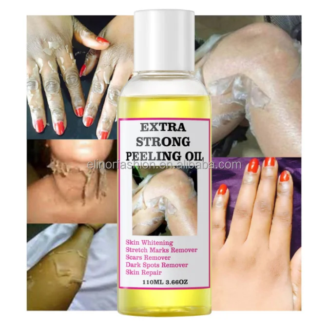 Best sale anti stretch marks multiple functions wholesale eternalelinor yellow peeling oil customized