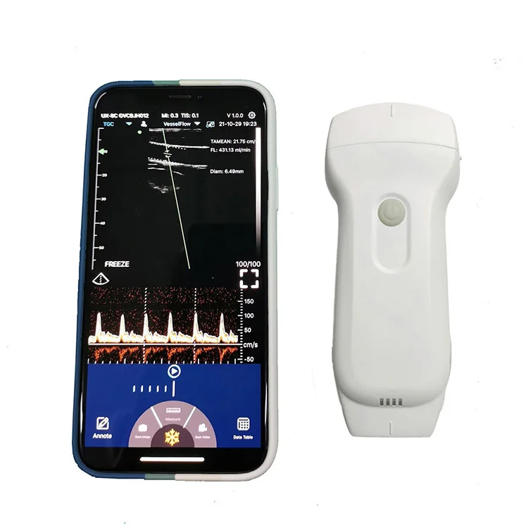 Professional Medical Devices C10RL Ultrasound Vein Illumination System, Infrared Viewer / Portable FinderClinical Analytical In