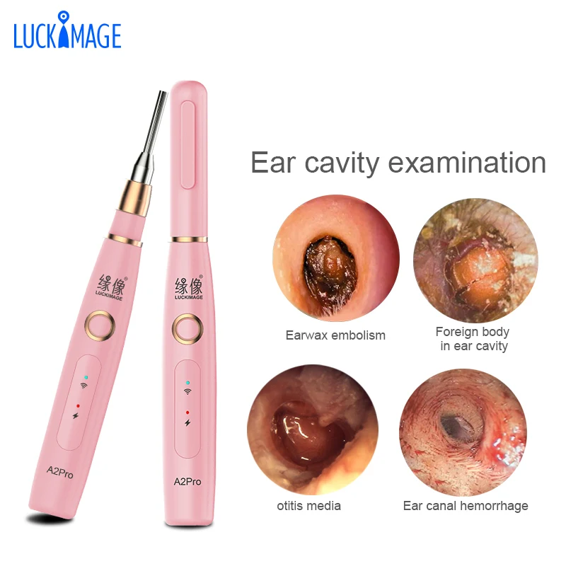  Luckimage завод поставщик видео цифровой hd wifi Телемедицина otoscope уха