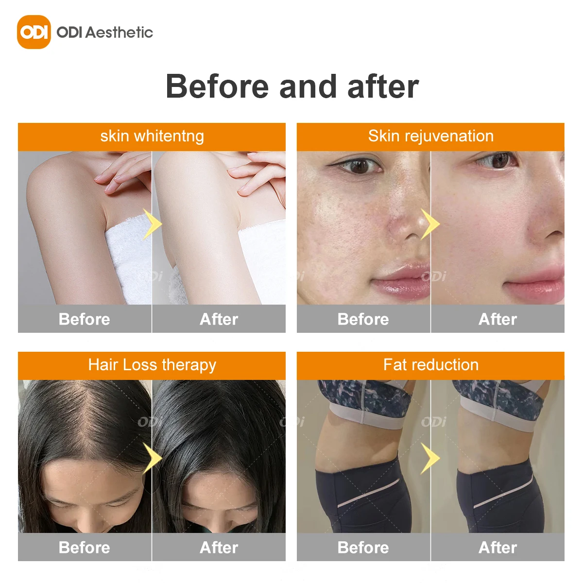 Led Light Therapy Spa Equipment Spa Capsule UV And Collagen Red /Blue Light Collagen Solarium Tanning Bed