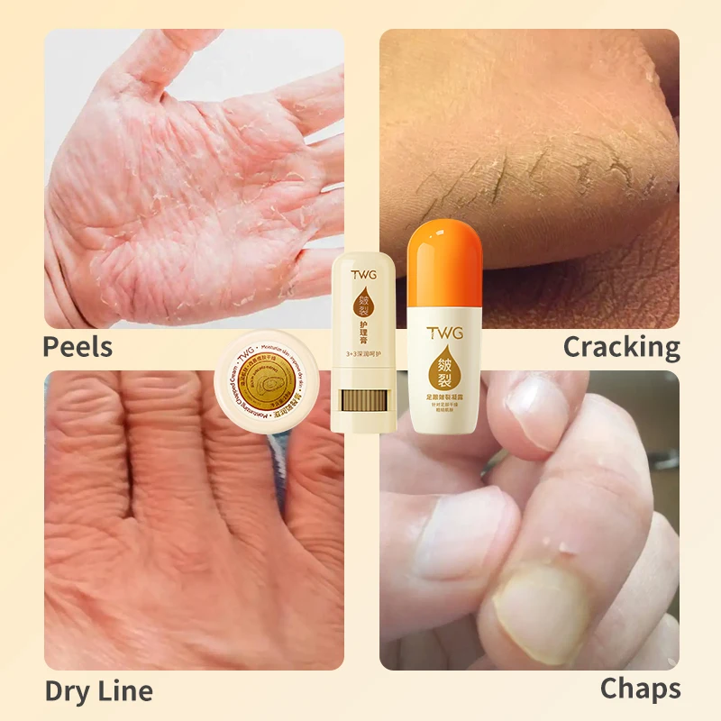 TWG Acid Dry Cracked Heel Callus Remover Skin Care Products Body Care Rejuvenating Set Moisturizing Foot Cream Balm