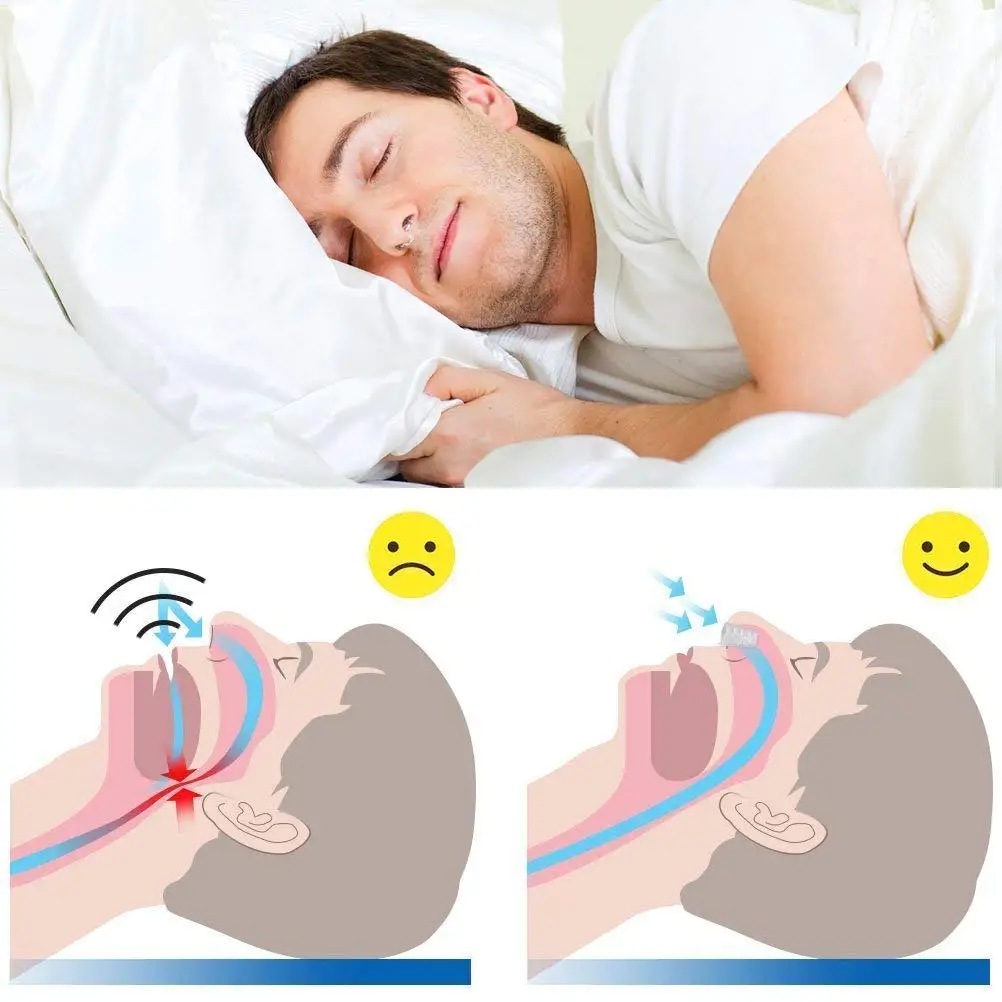 Anti Snoring Silicone Mouthguard Stop Snore Instrument Device Silence Sleeper Mouthpiece