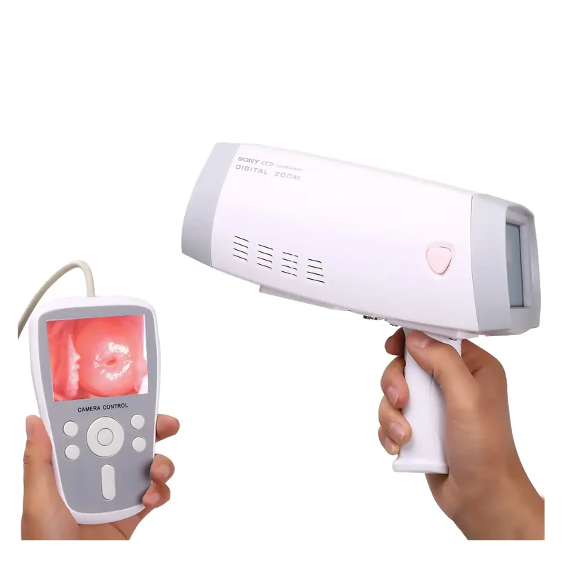 YD-220 High Quality Digital Video Vagina Colposcope Portable Colposcopy Gynecology Examination Equipment