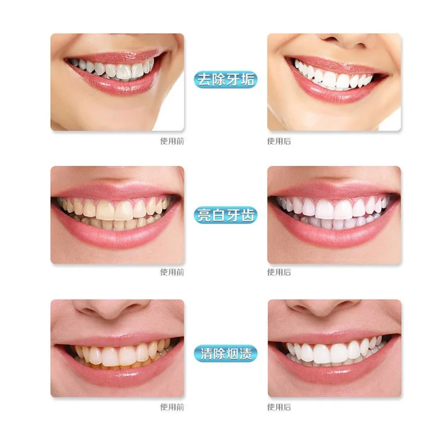 Dental Equipment Led Teeth tooth Whitening Bleaching System Oral hygiene care Gel Kit for smoke teeth Home Use Kit