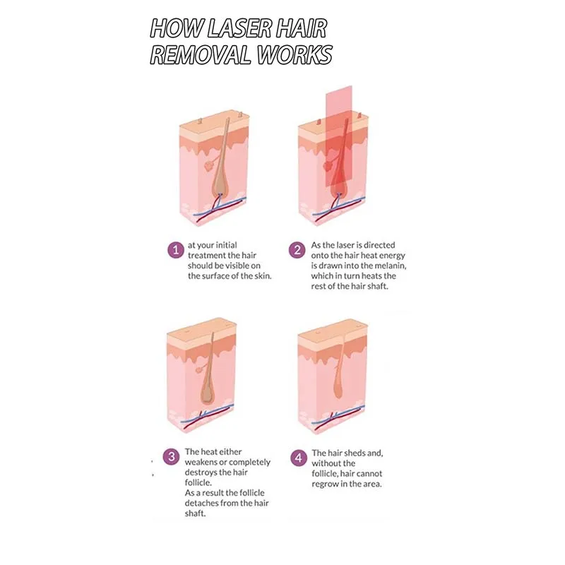 Portable 808 diode hair removal beauty device 3 wavelengths of strong pulse light hair removal salon equipment