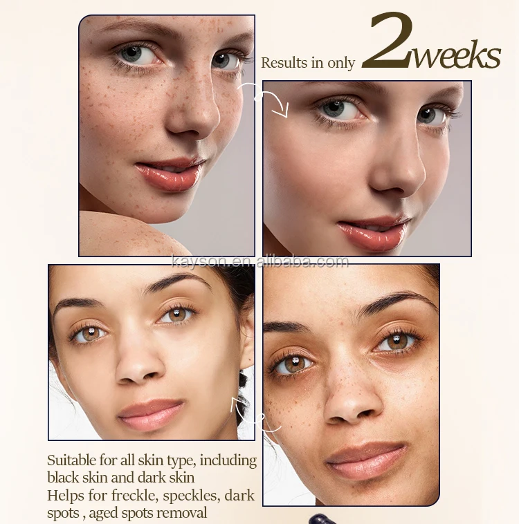 Herbal Extract Anti Spot Whitening Night Freckle Removing Cream for Face Made in Japan