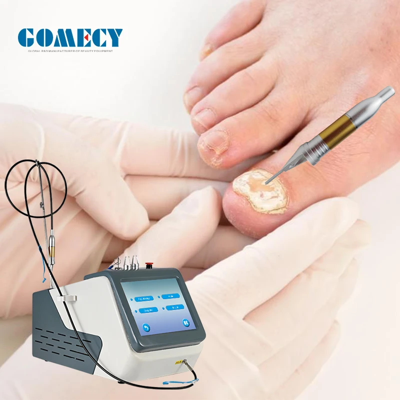 New invention product 980nm 905nm laser toenail nail fungus treatment machine