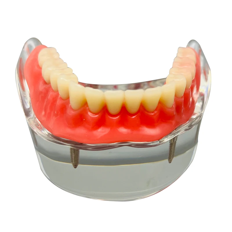 Medical Student Practice research Restoration Dental Implant Teeth Model