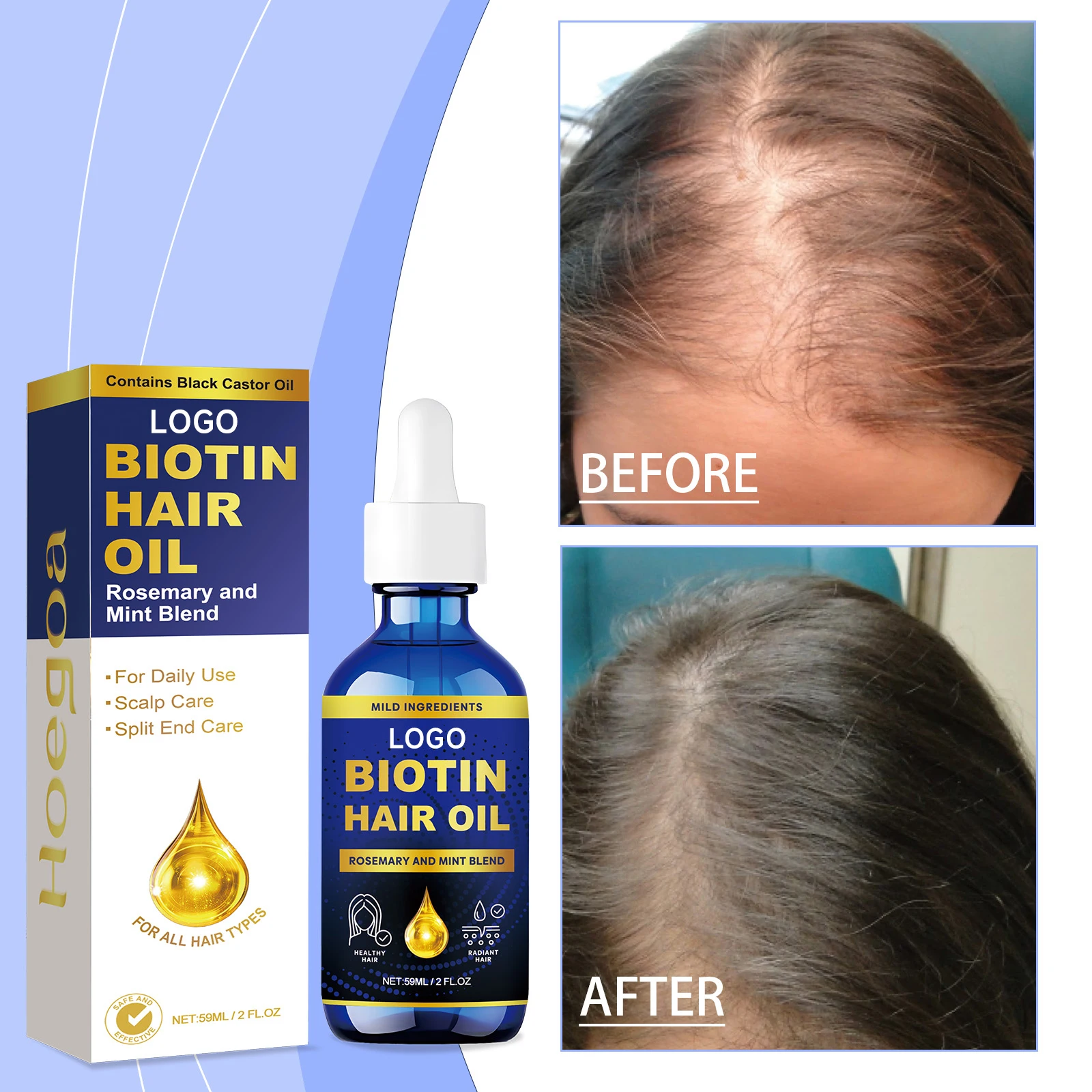 Rosemary Nourishes Scalp Nourishing hair Serum Rosemary Essential Oil for Hair Growth