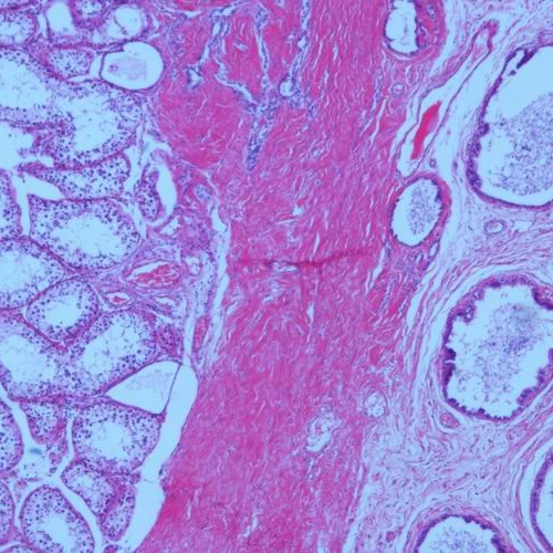 Parasite Microscope Mammal Histology Simple Squamous Epithelium Slides Lab Microscope Glass Slides