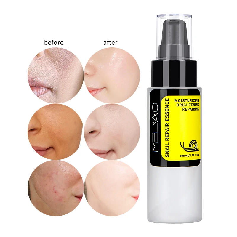 Private Label Skincare Mucin Advanced Snail 96 Mucin Power Essence Wholesale  Low MOQ Niacinamide Snail Serum Essential