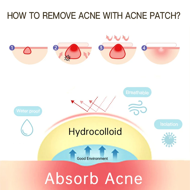 Private Label OEM ODM clear acne cover patch sticker acne pimple patch for skin care pimple patches