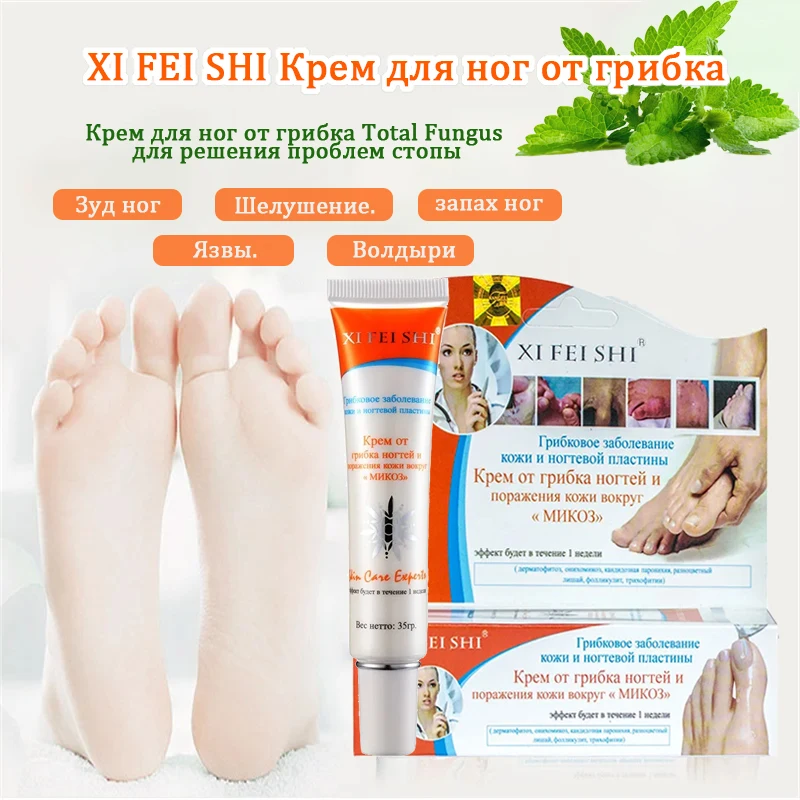 Antiallergic Antipruritic Anti-inflammatory Medicinal Ointment,skin ointment cream