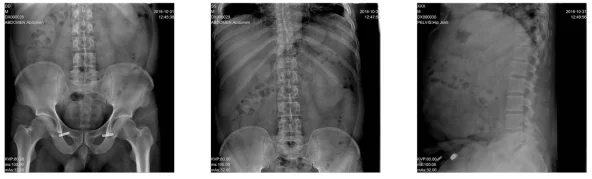 Factory direct sales high frequency big screen DR digital radiography machine computed radiography system x ray machine