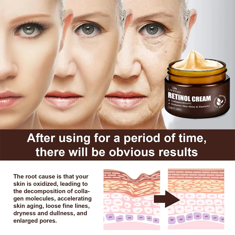 private label organic Remove Wrinkle Vitamin E Hyaluronic Acid Moisturizer anti aging 3% retinol face cream