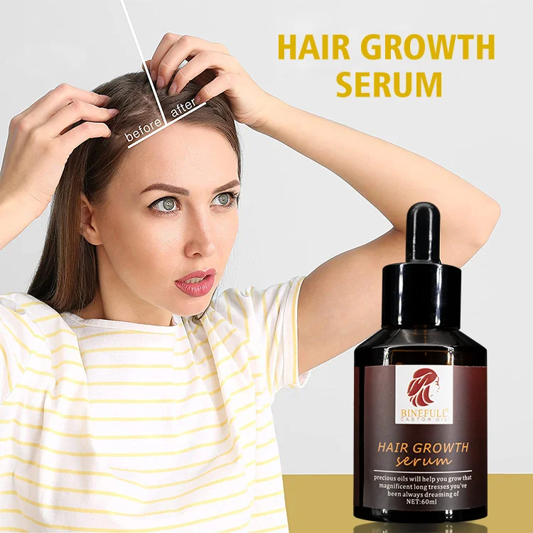 Private Label Natural Ginger Hair Growth Oil  Anti Loss Treatment Hair Oil Fast Hair Growth Serum