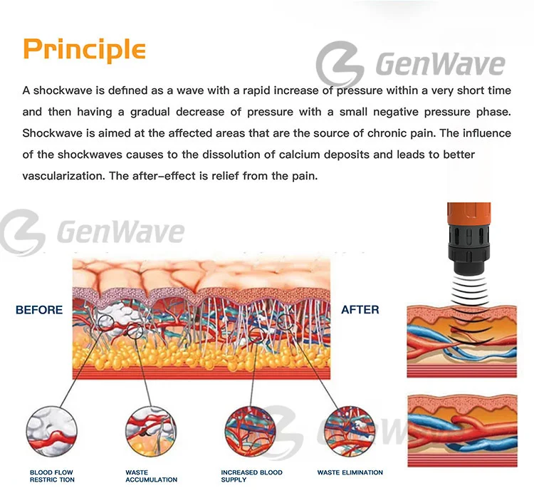 Shockwave For Horse Shockwave Therapy Device ESWT Equine Machine Pain Therapy  Equine Wave Horses Therapy Machine