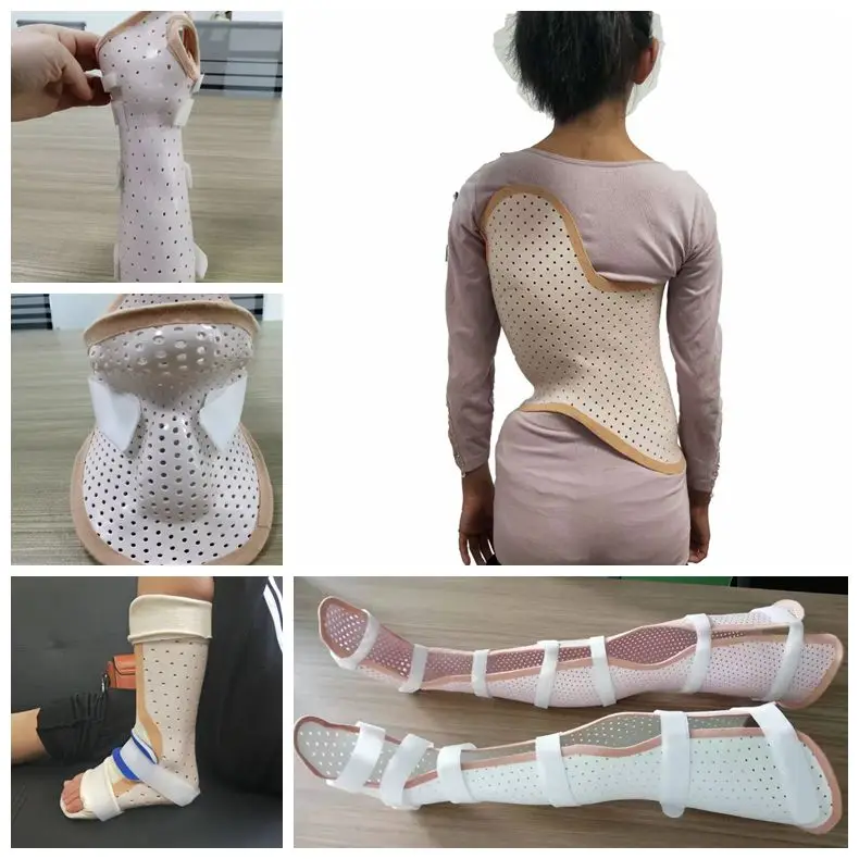 orthopedic splint types.jpg