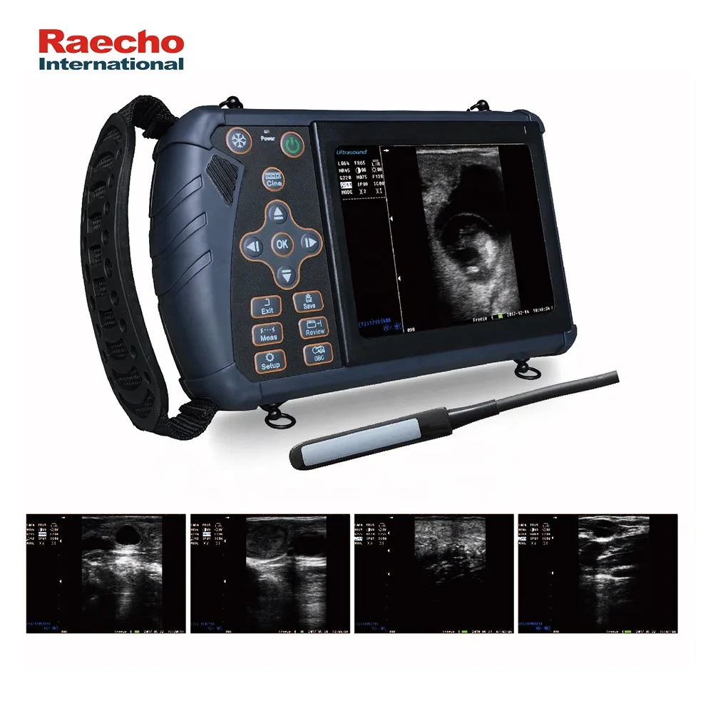 Medical Handheld Ultrasound Scanner Vet