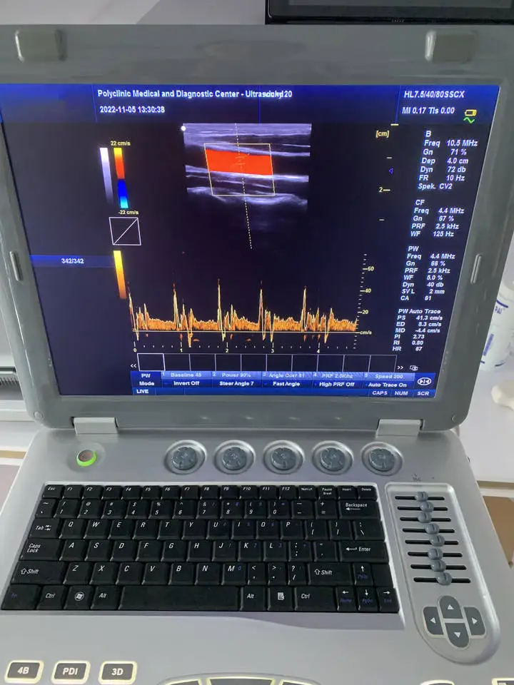 JM-906B laptop ultrasonic machine cheap 3D 4D Color Doppler scanner with battery